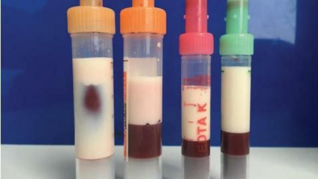 Una segunda oportunidad para las grasas.