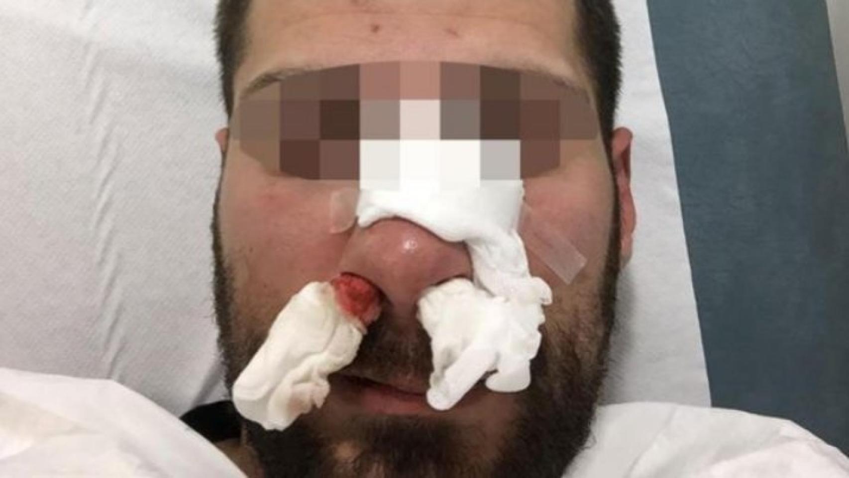 El agente de la UIP agredido en Melilla requirió de atención hospitalaria.