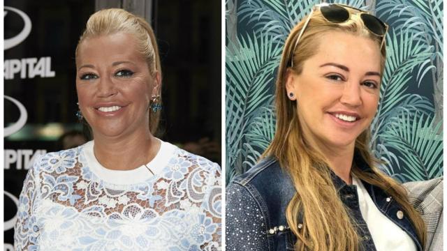 El antes y el después de Belén Esteban tras su tratamiento estético.