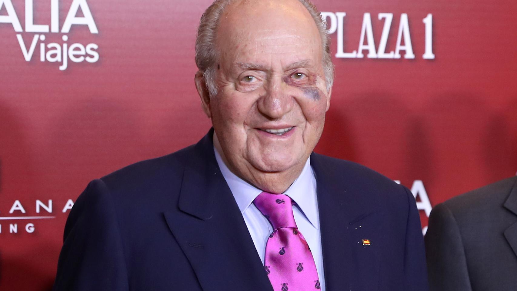 Detalle del ojo morado que ha lucido el rey emérito en el evento de este viernes.