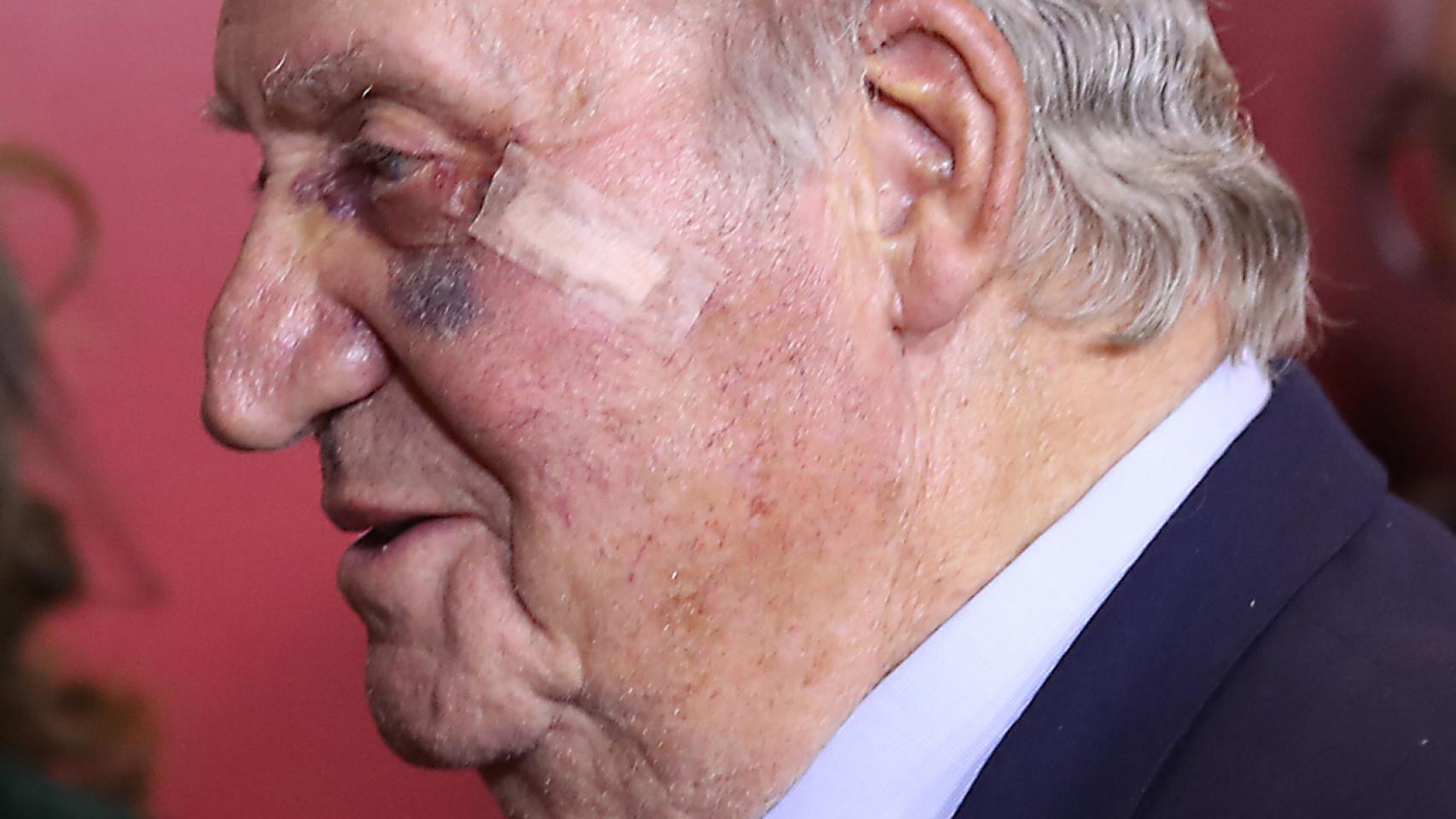 El Rey Emérito, el pasado marzo, cuando apareció con un hematoma en Las Ventas.
