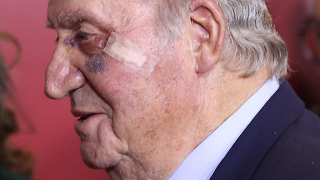 El Rey Emérito, el pasado marzo, cuando apareció con un hematoma en Las Ventas.