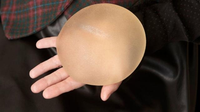 Un implante de silicona.