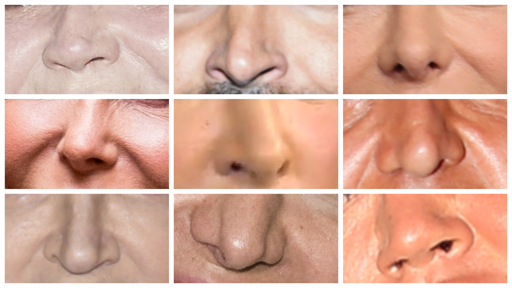 Un montaje con algunas narices de famosos.