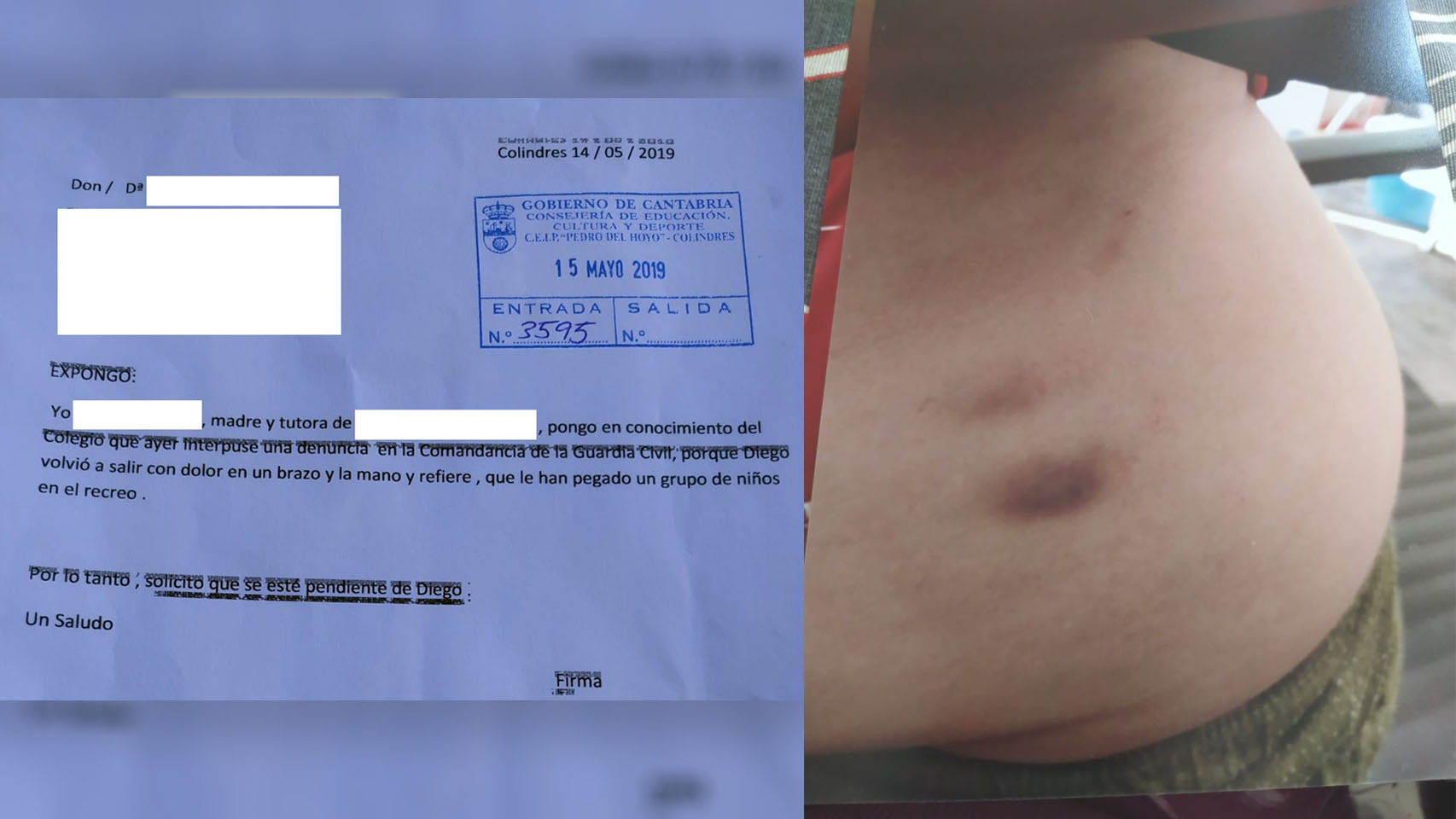 Los hechos han ocurrido en un colegio de Colindres (Cantabria). Foto cedida por la Asociación Tolerancia 0 al Bullying.