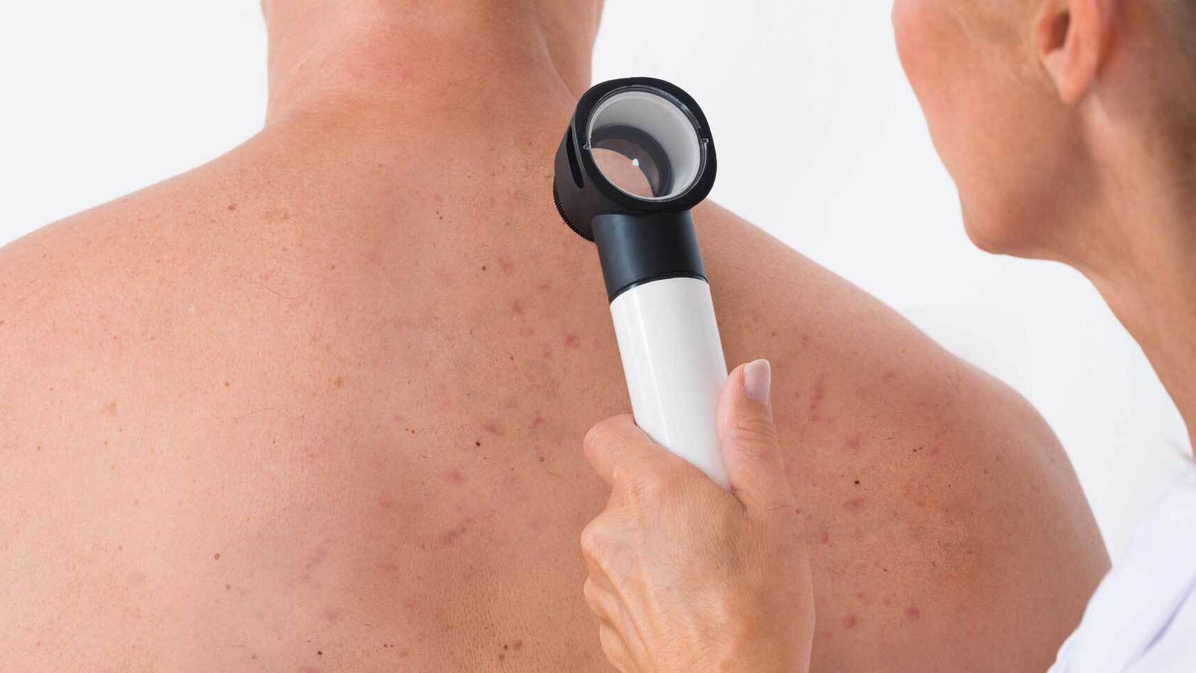 Los mejores médicos dermatólogos