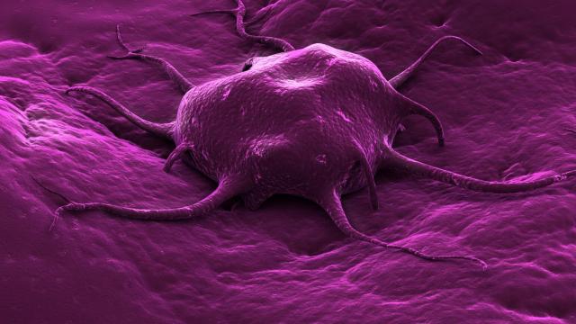 Un tumor creciendo.