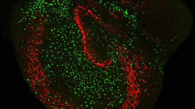 El cerebro de una rata con los dos tipos de células marcadas