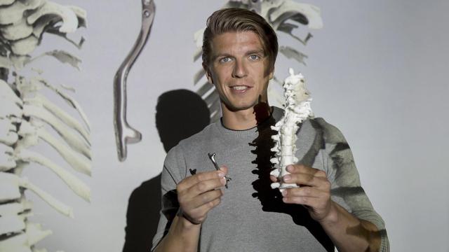 Un adolescente vuelve a andar gracias a un implante espinal impreso en 3D