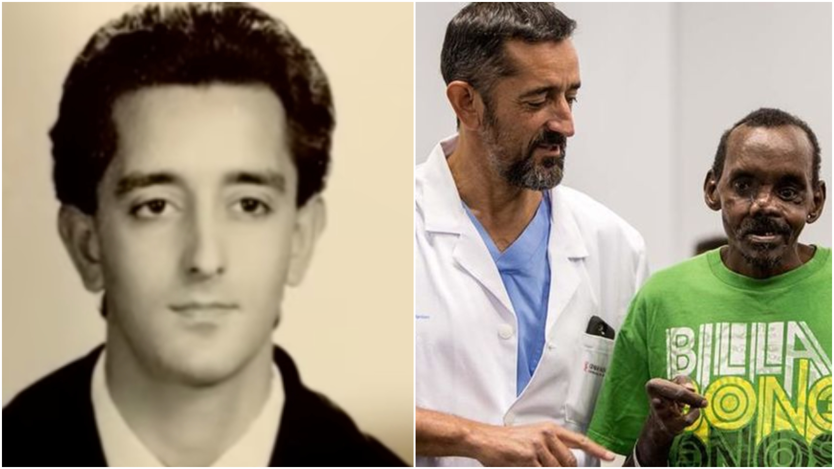 A la izquierda, Pedro Cavadas en su etapa universitaria; a la derecha, el cirujano presenta el rostro y la mano reconstruidos de Lonunuku en 2018.