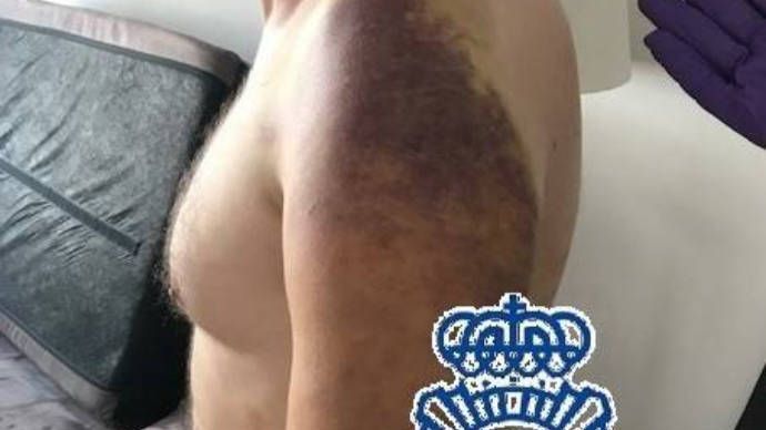 Foto: Policía Nacional