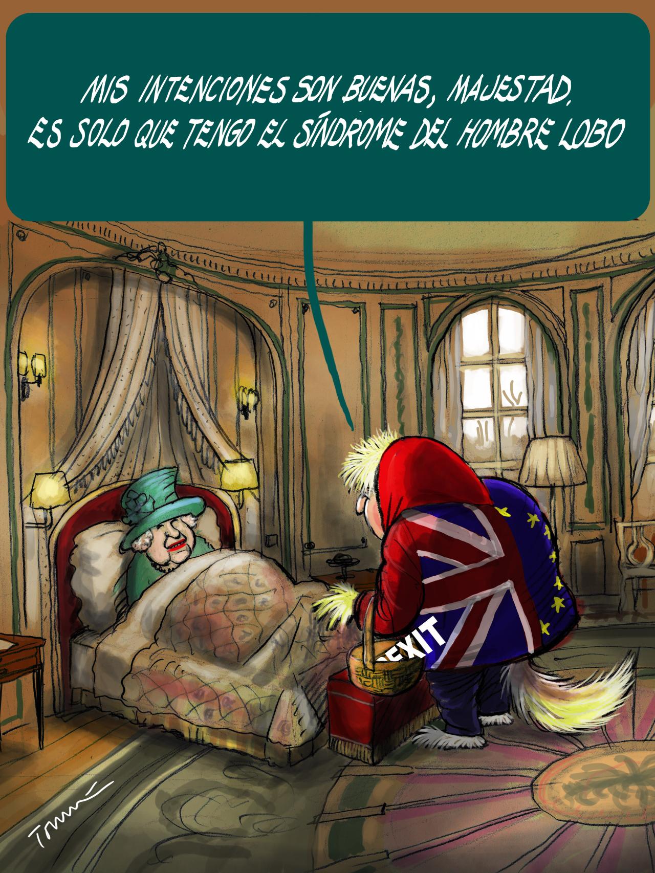 Síndrome del hombre lobo