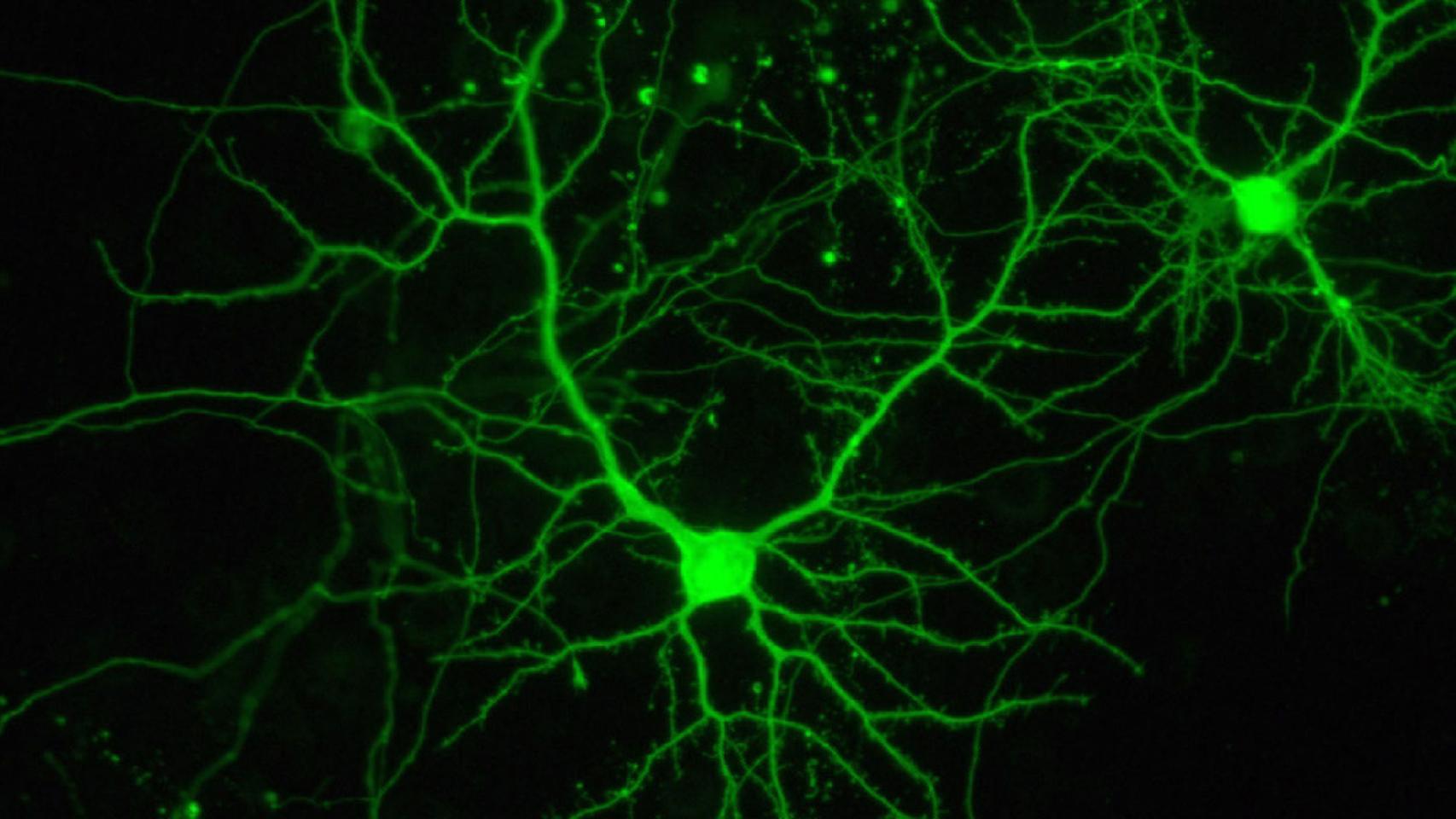 Cómo usar tecnologías fotónicas para tratar tumores, lesiones cerebrales y epilepsia