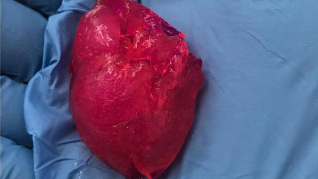 Corazón impreso en 3D