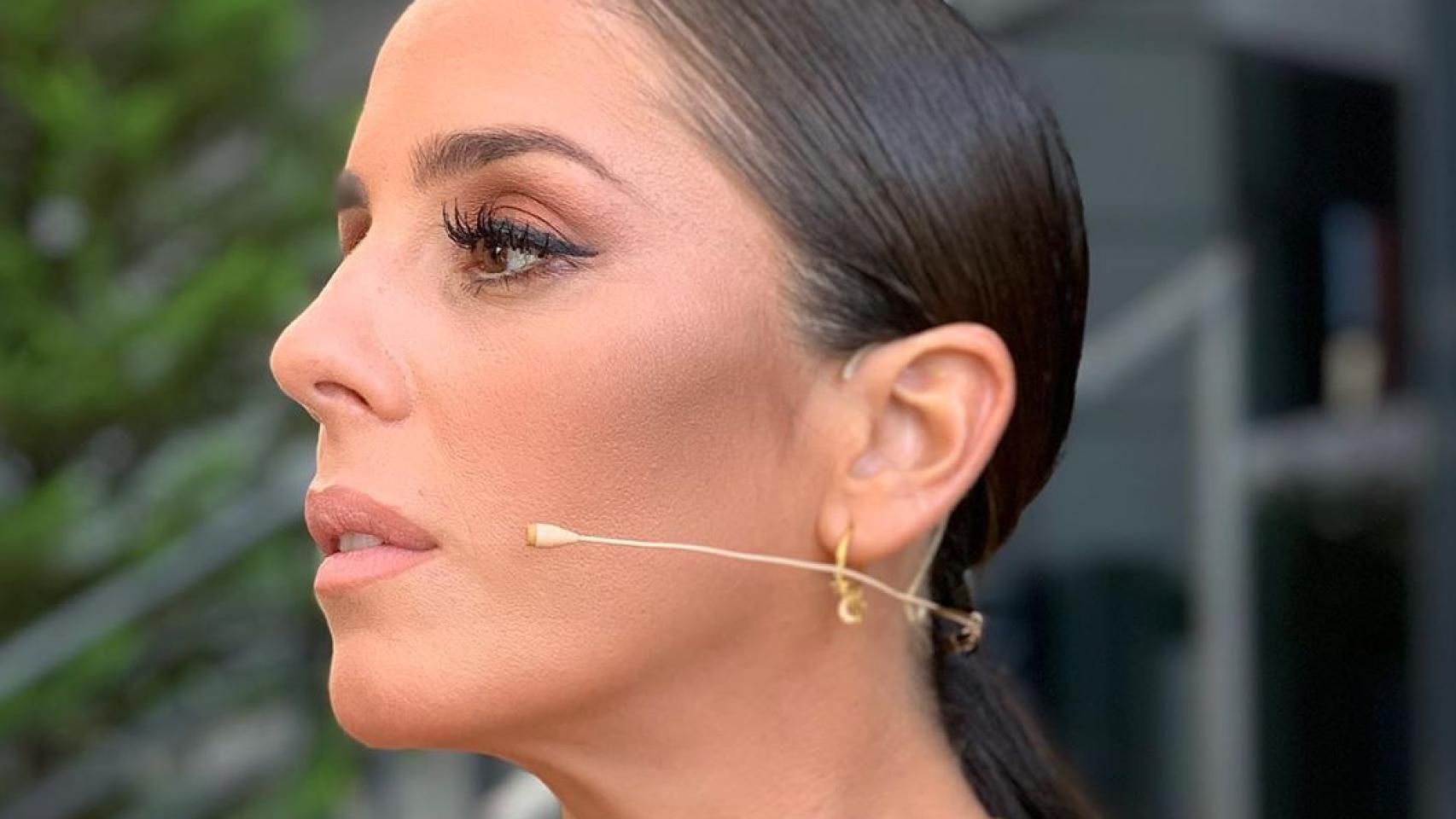 Imágenes del día: los sospechosos dientes de Anabel Pantoja en Instagram, ¿brackets o carillas?