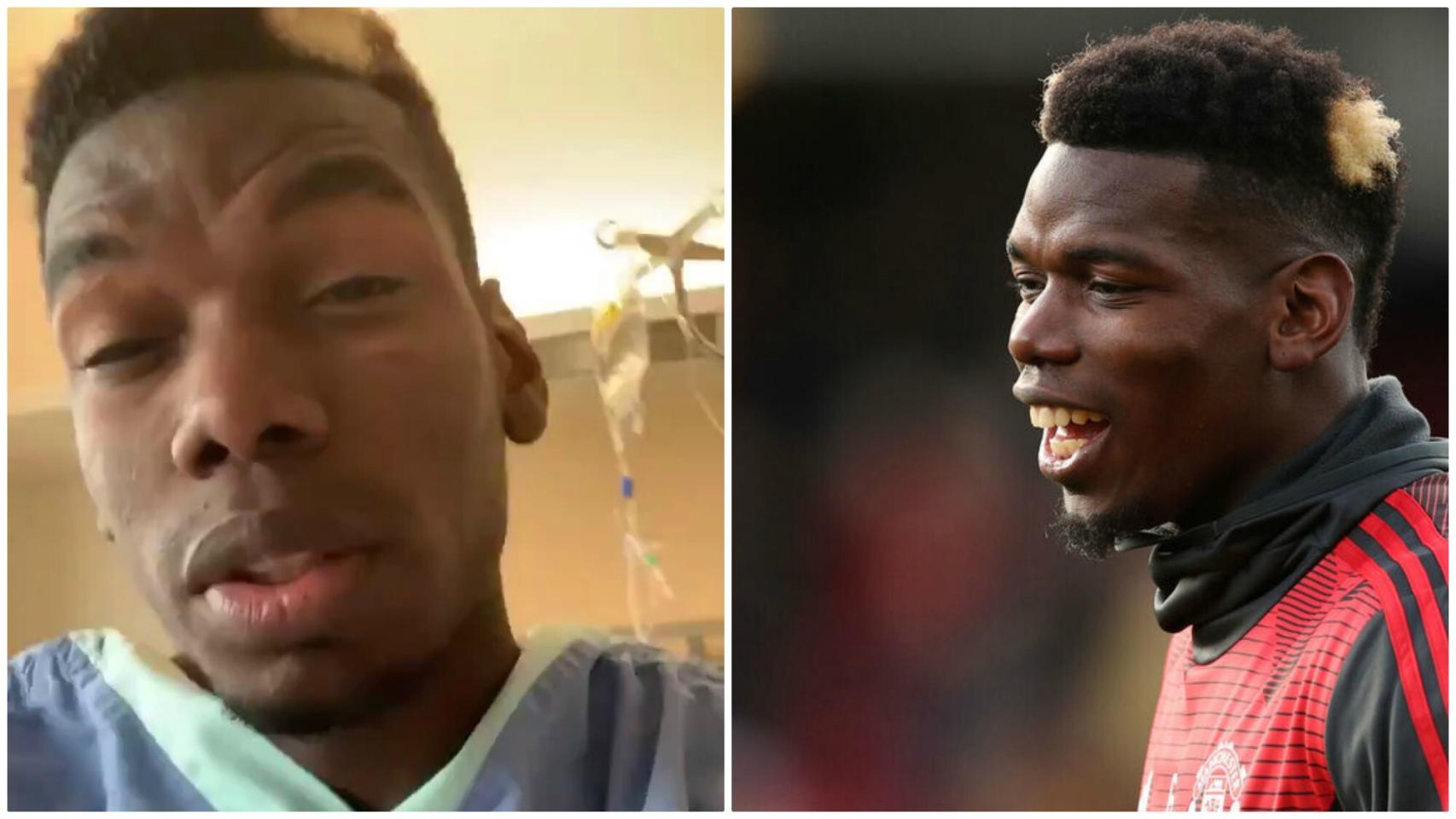 Pogba se opera del tobillo y manda un mensaje a sus seguidores