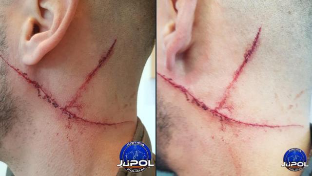 Heridas producidas al GEO de la Policía Nacional.