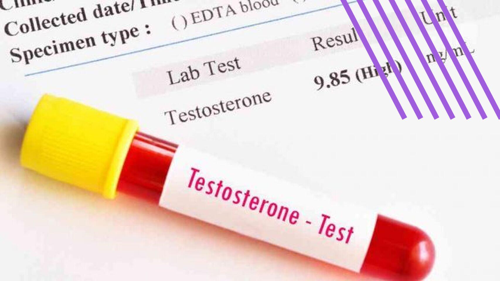 Testosterona.