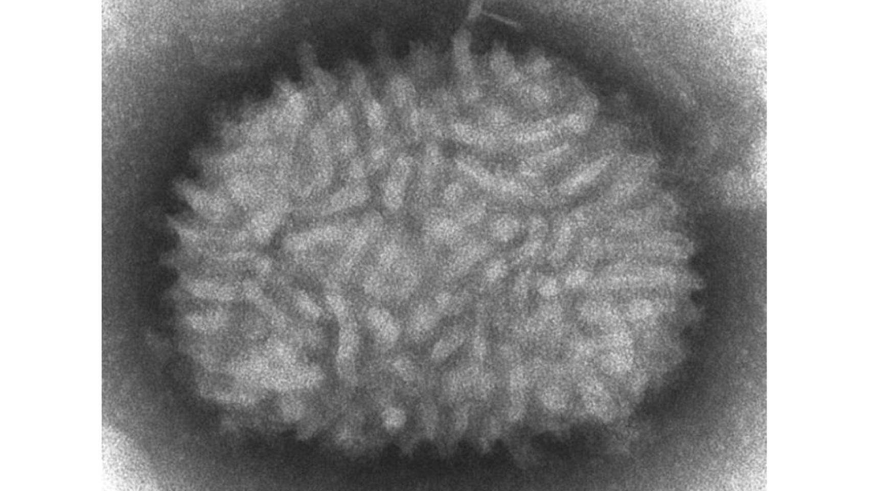 Imagen al microscopio del virus Vaccinia.