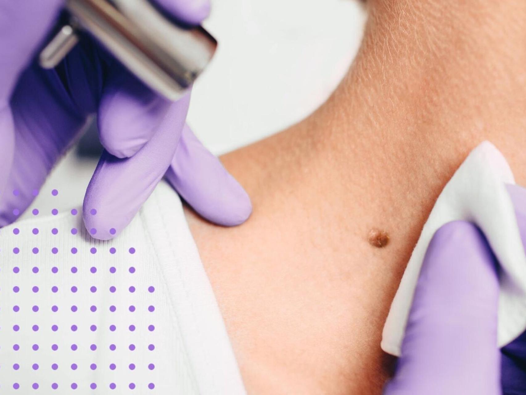 Coronavirus-Enfermedades_infecciosas-Infecciones-Dermatologia-Cancer-Saludables_480712411_149860942_1706x960 (1)