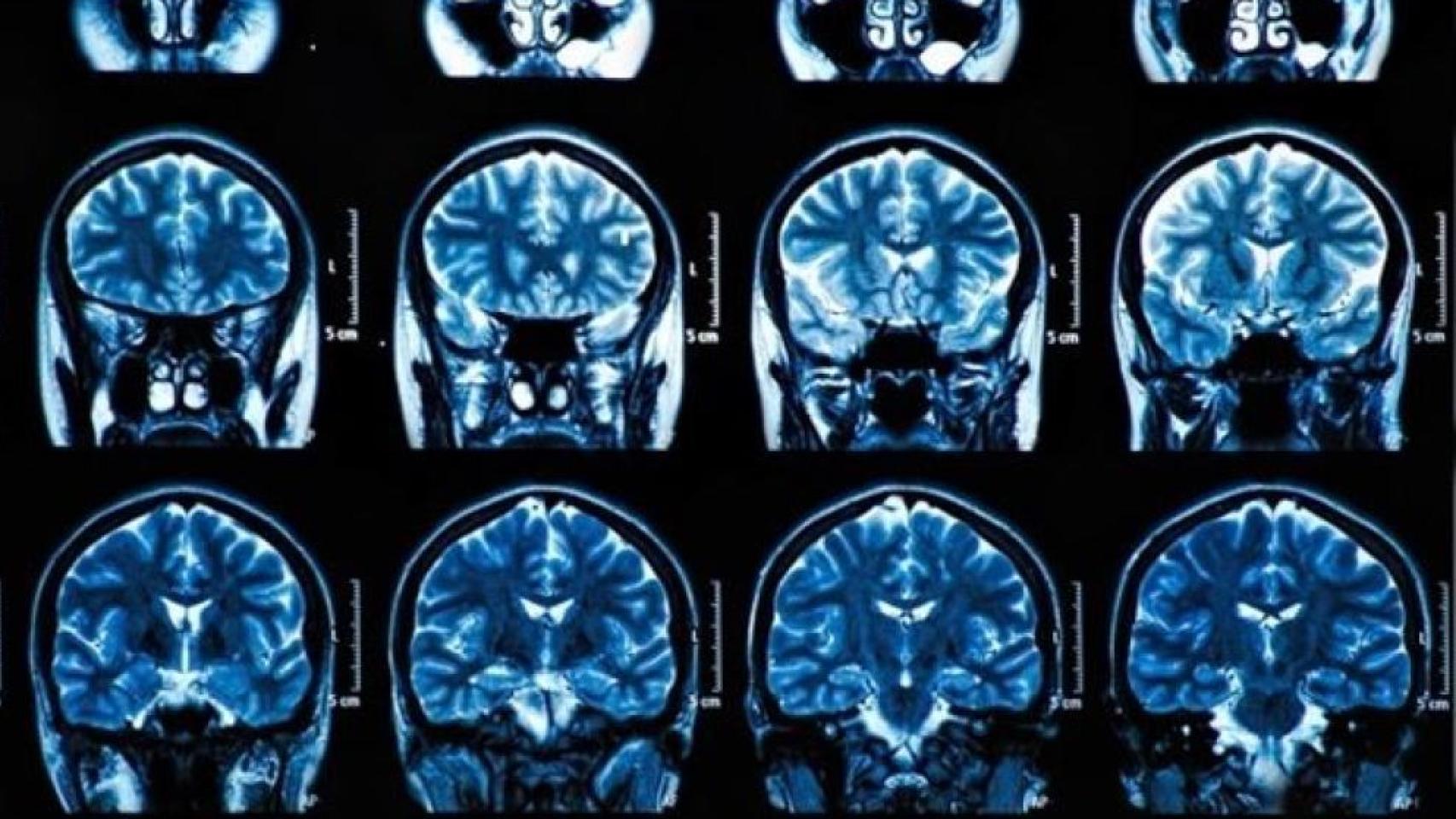 Un escáner cerebral.