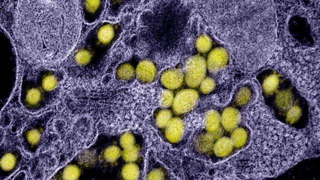 Micrografía electrónica de transmisión de partículas del virus SARS-CoV-2.