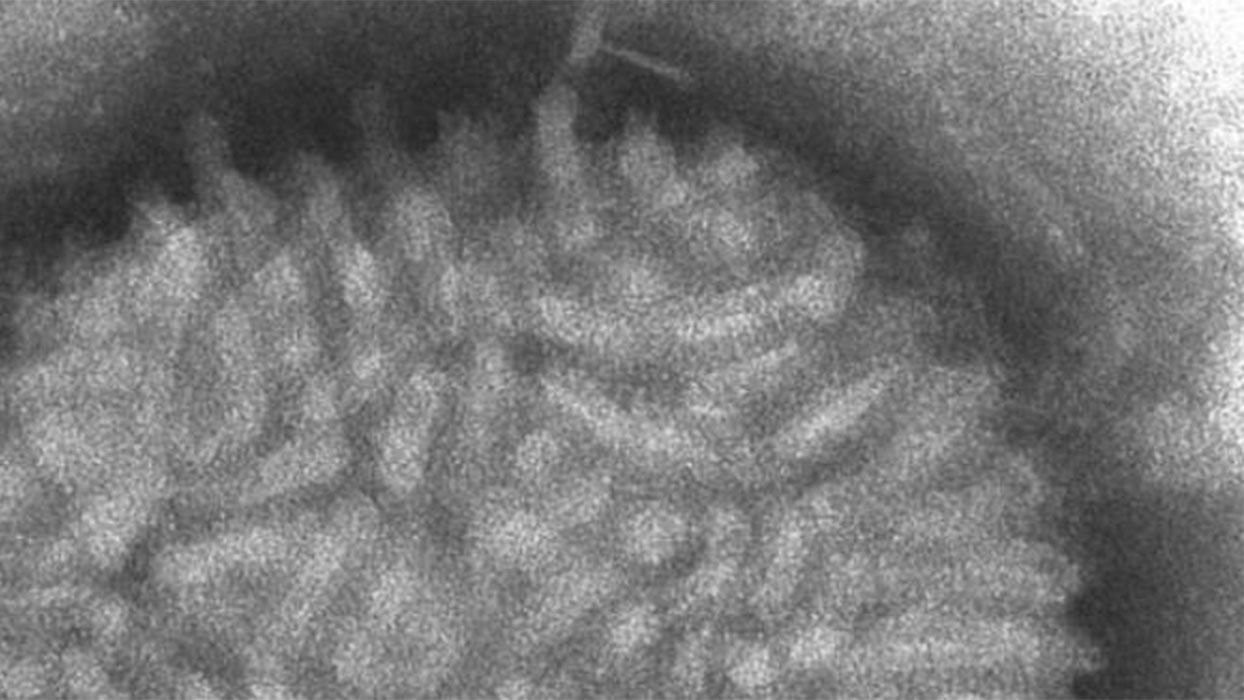 Imagen al microscopio del virus Vaccinia.
