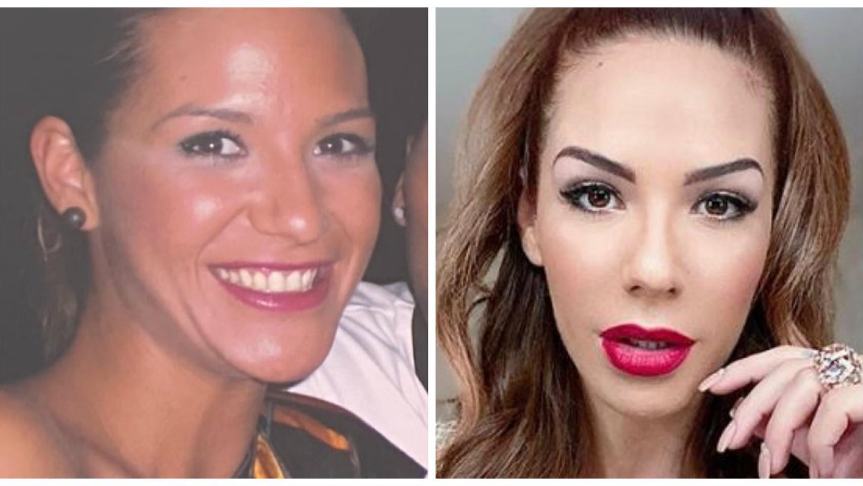 Tamara Gorro en una comparativa de su antes y después.