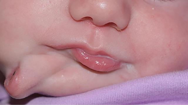 La pequeña paciente.  BMJ Case Reports.