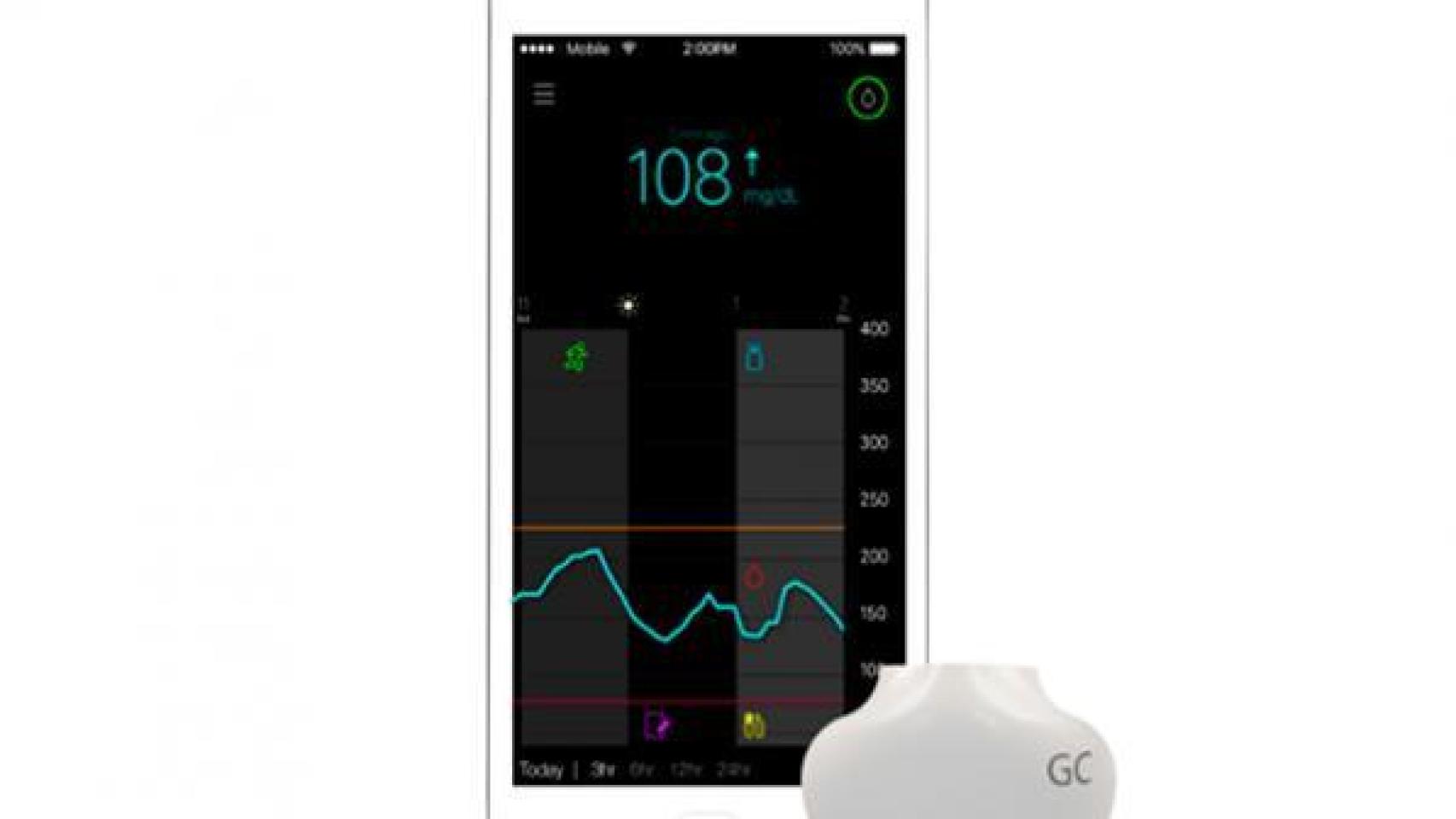 Sistema de control de glucosa de Medtronic.