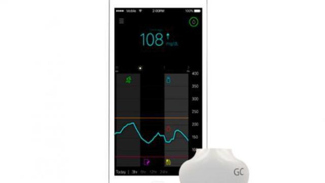 Sistema de control de glucosa de Medtronic.