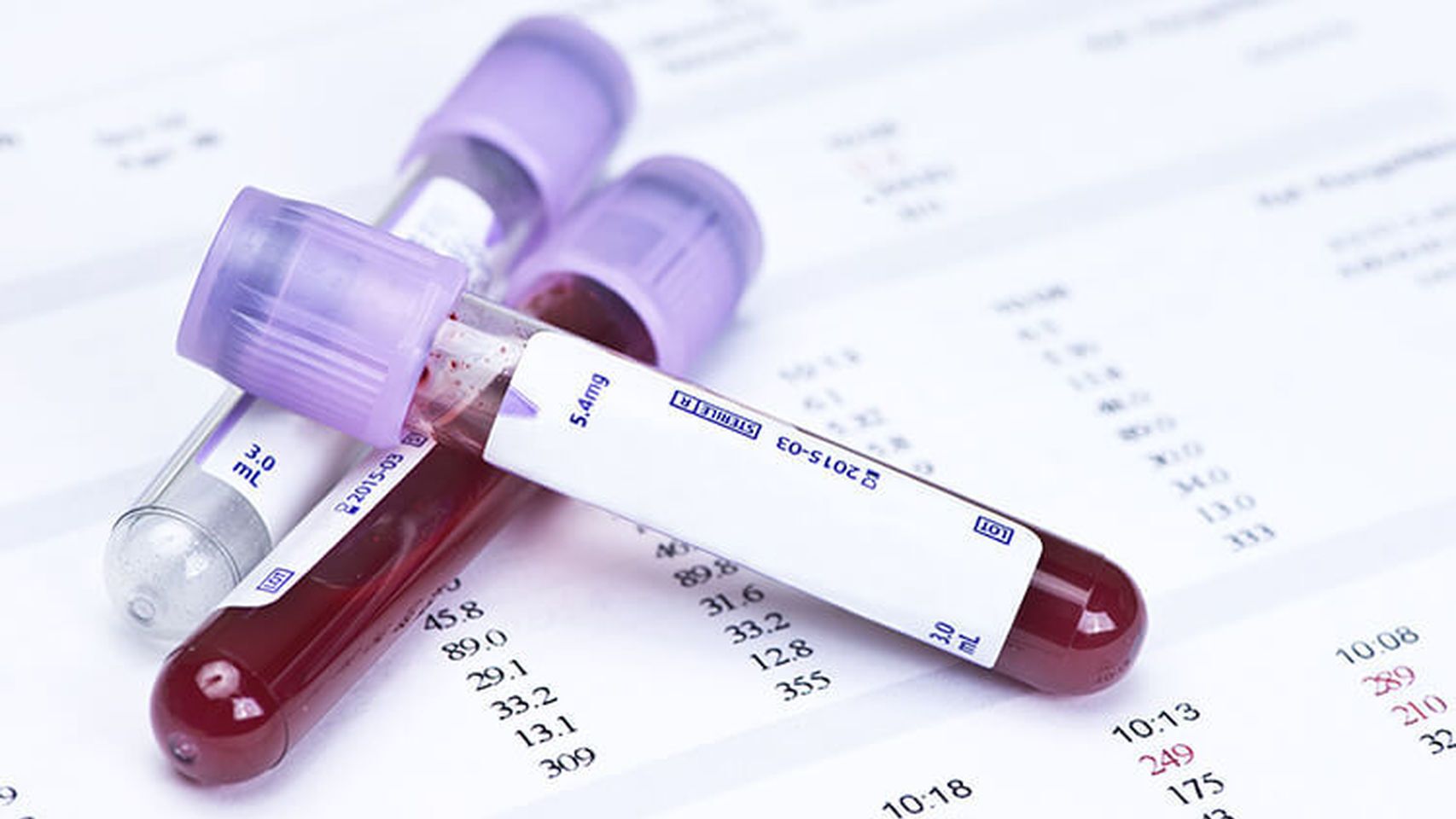Unas muestras de sangre de una analítica.