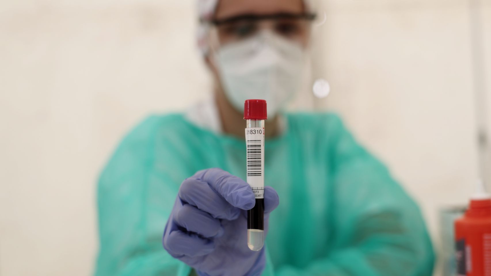 Un sanitario muestra un tubo de ensayo con muestras de un paciente de Covid-19.