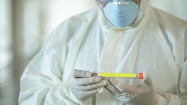 El CHUAC comienza a cribar a los coruñeses de entre 18 y 40 años