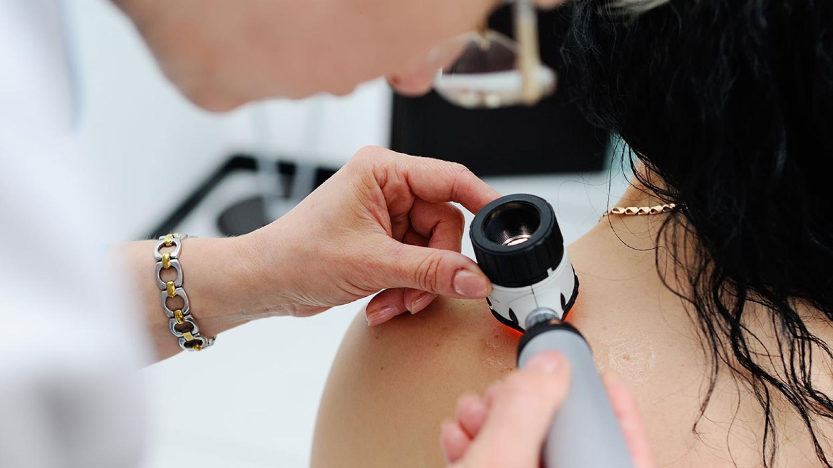 Esta cabina ‘made in Spain’ es capaz de detectar posibles melanomas gracias a la IA