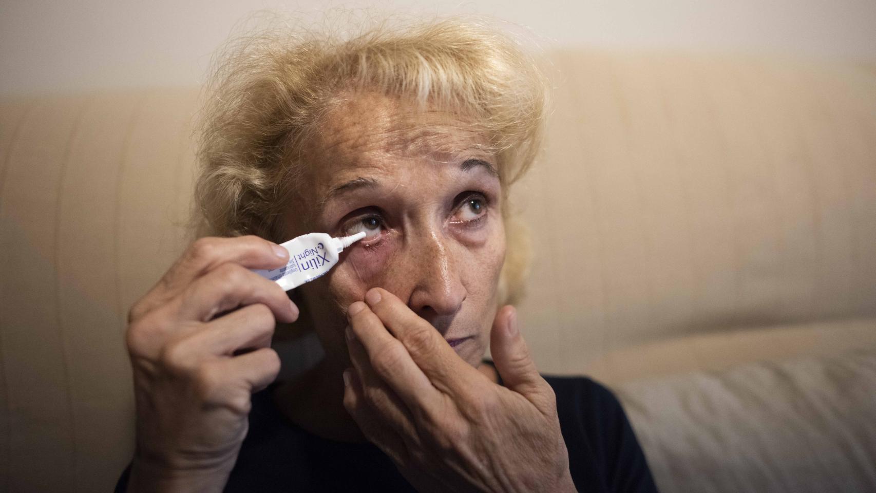 Pilar Martínez sufre una parálisis facial a causa del estrés.