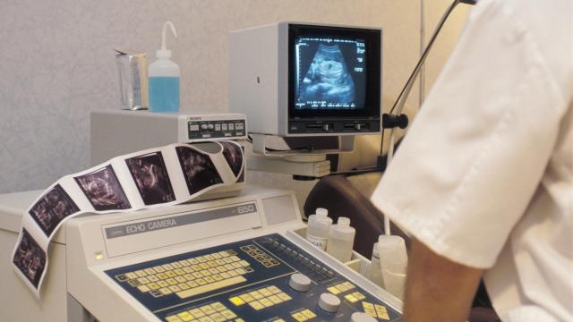 Una revisión ginecológica.