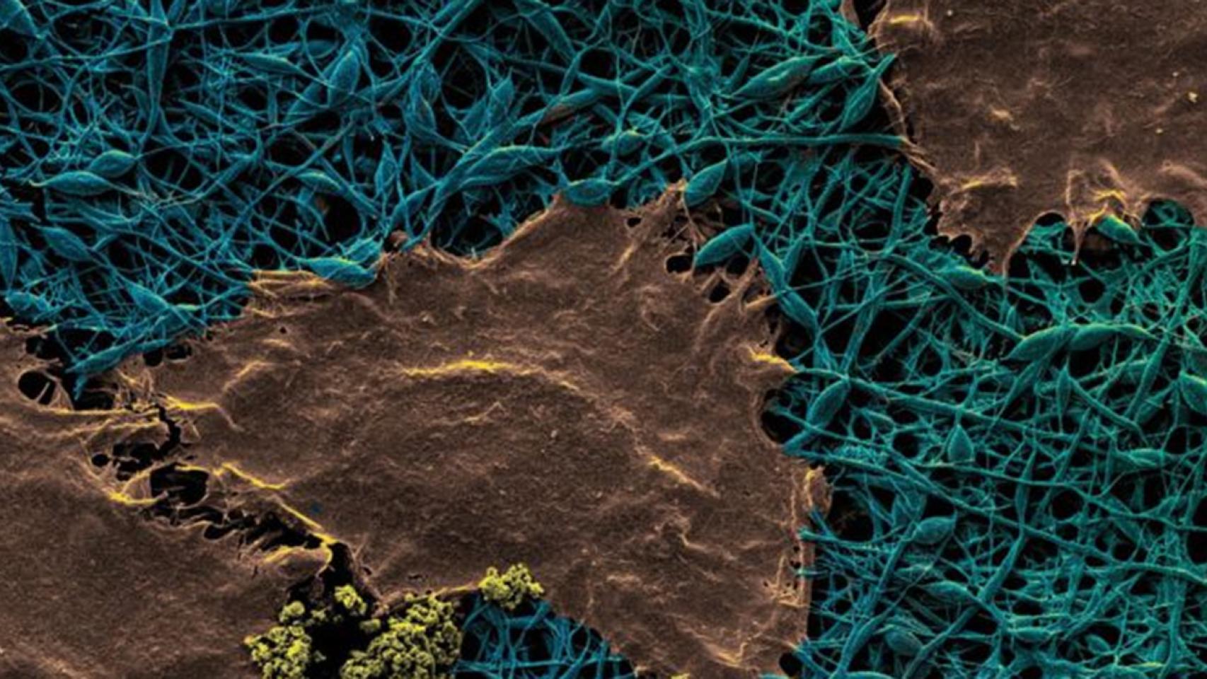 Nanodiamantes que mejoran la cicatrización de las heridas
