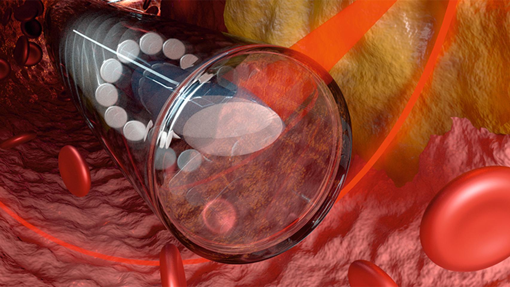 Un nanoendescopio impreso en 3D permite acceder al interior de las venas