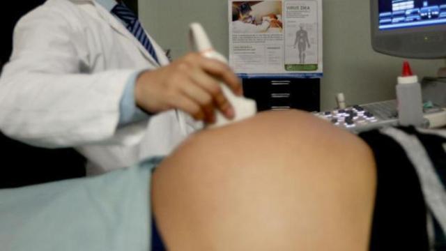 Una embarazada sometiéndose a un control.
