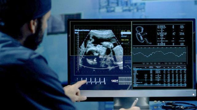 Un técnico analiza una ecografía.
