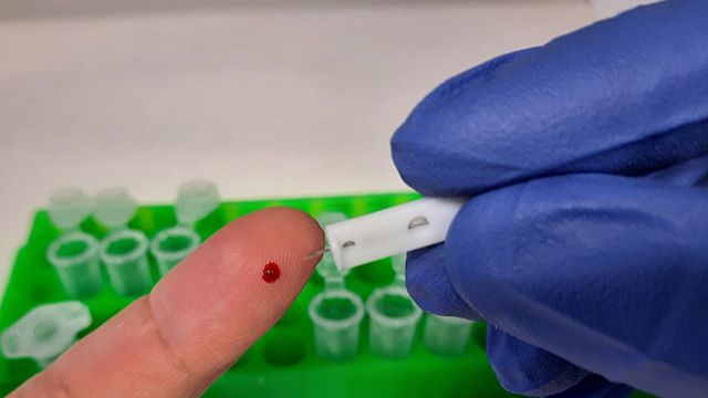 Imagen de la extracción de la gota de sangre necesaria para el test de anticuerpos. Foto: CBM-CSIC-UAM