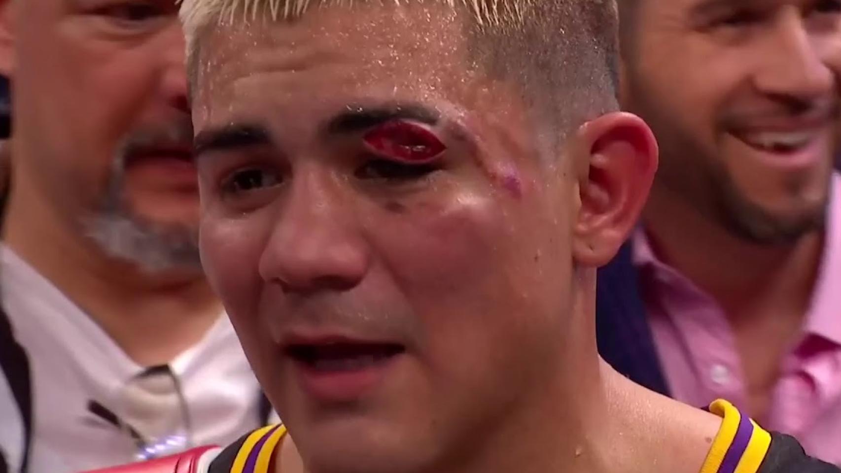 Joseph Díaz Jr. después de un combate