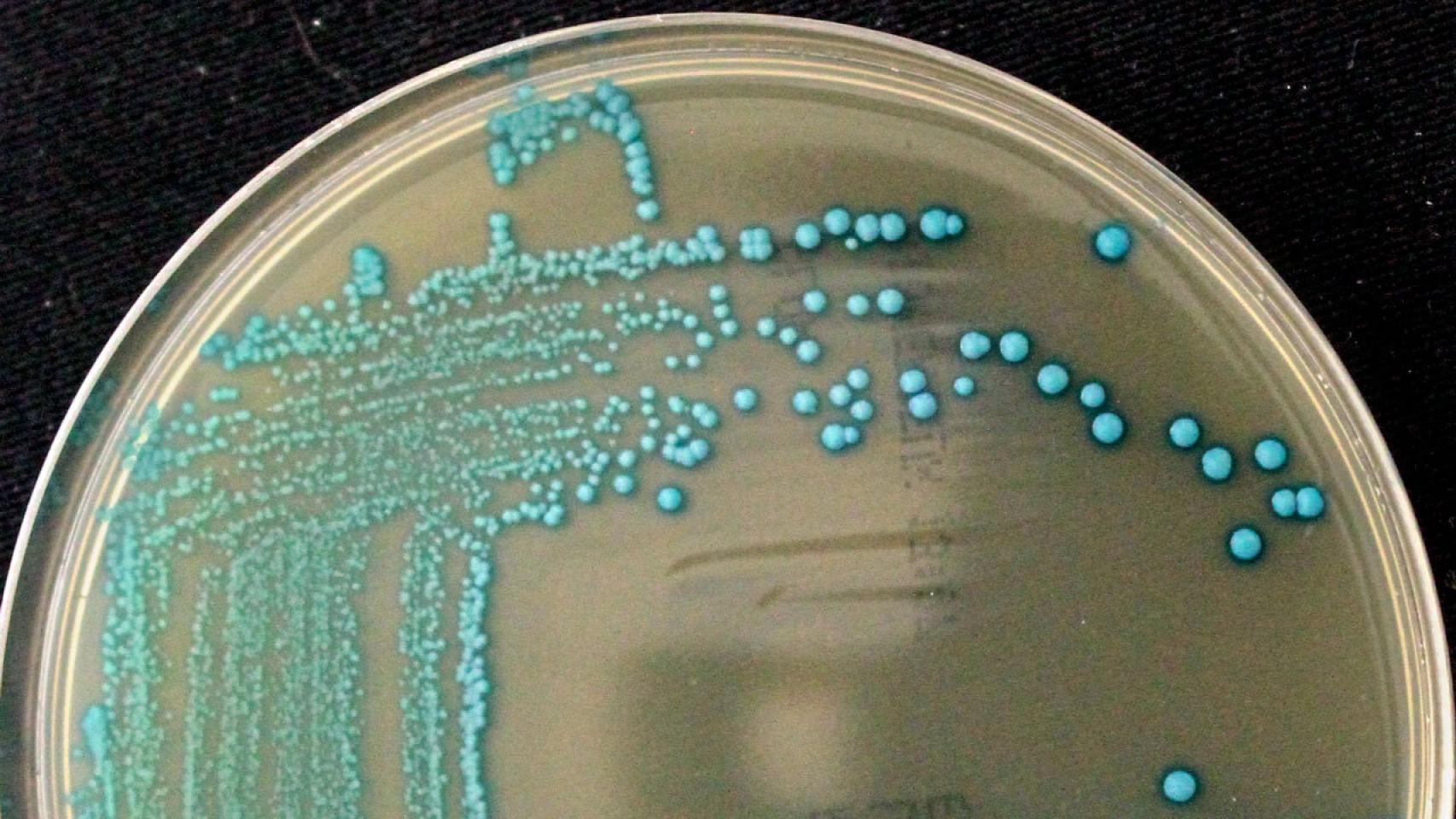 Listeria cossartiae / Catharine Carlin, Cornell University.