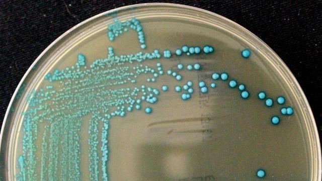 Listeria cossartiae / Catharine Carlin, Cornell University.