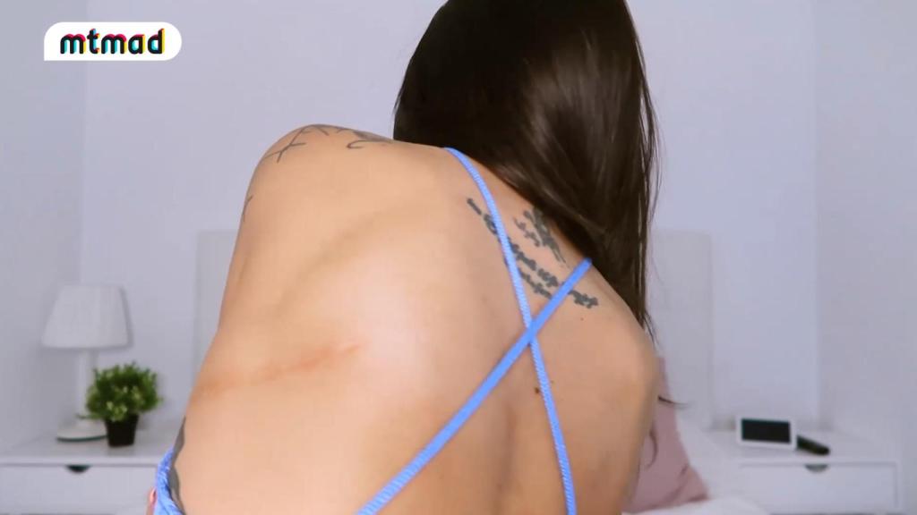 Fiama ha mostrado la cicatriz de su operación.