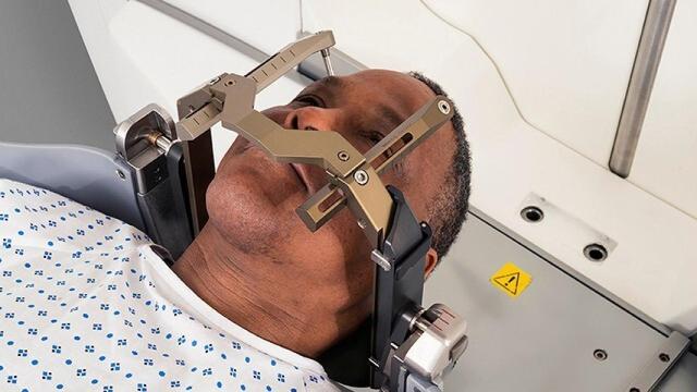 Un paciente hace uso de una Leksell Gamma Knife, el equipo contra el cáncer donado por Amancio Ortega a Valencia. EE