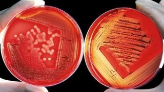 Crean por primera vez una bacteria inmune a las infecciones virales