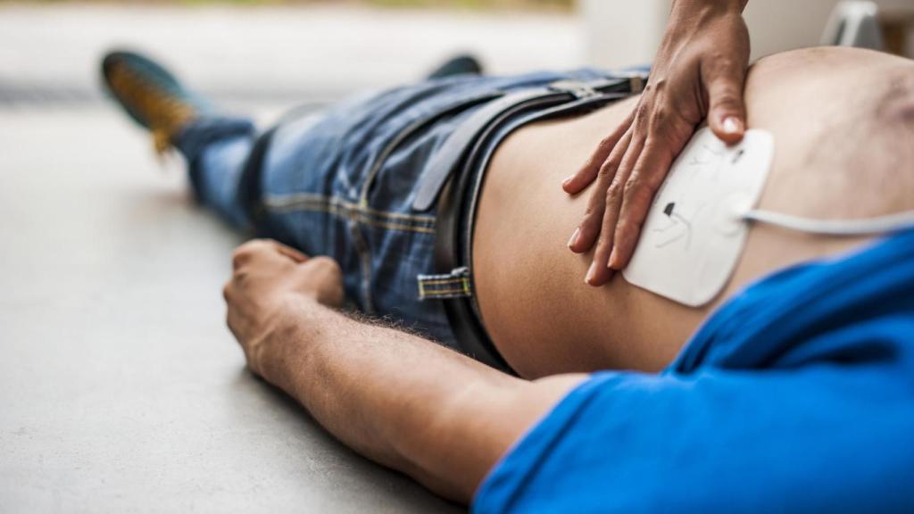 Imagen de archivo de una rcp con un desfibrilador