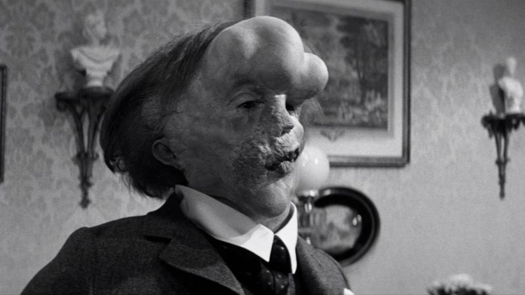 Fotograma de la película 'El hombre elefante'.